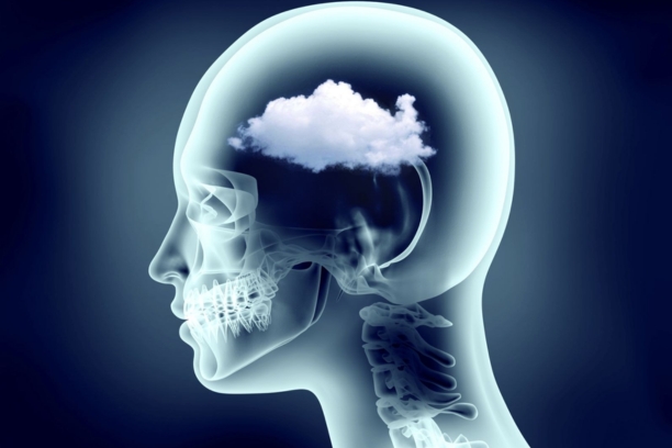 Brain Fog and Cognitive Issues