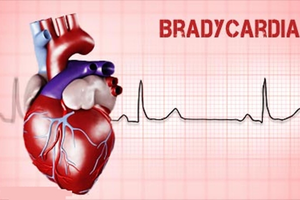  Bradycardia
