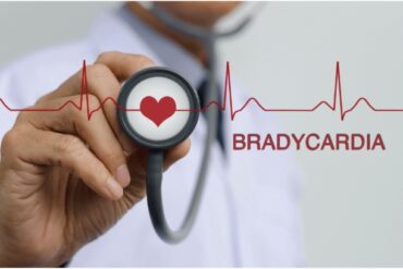 Holistic Approaches to Tachycardia