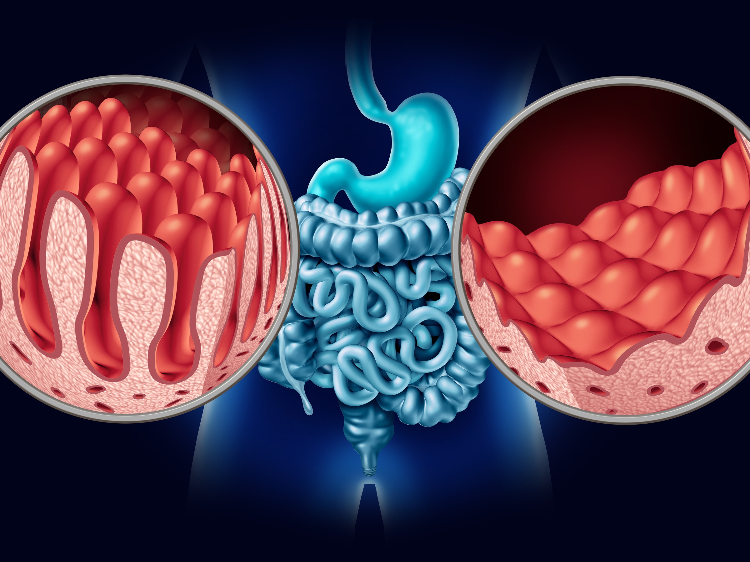 Celiac Disease Management, Symptoms and Treatment Untitled Design 14