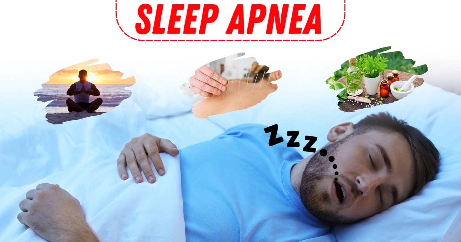 Sleep Apnea: Causes, Prevention, and Natural Treatments for Restful Sleep