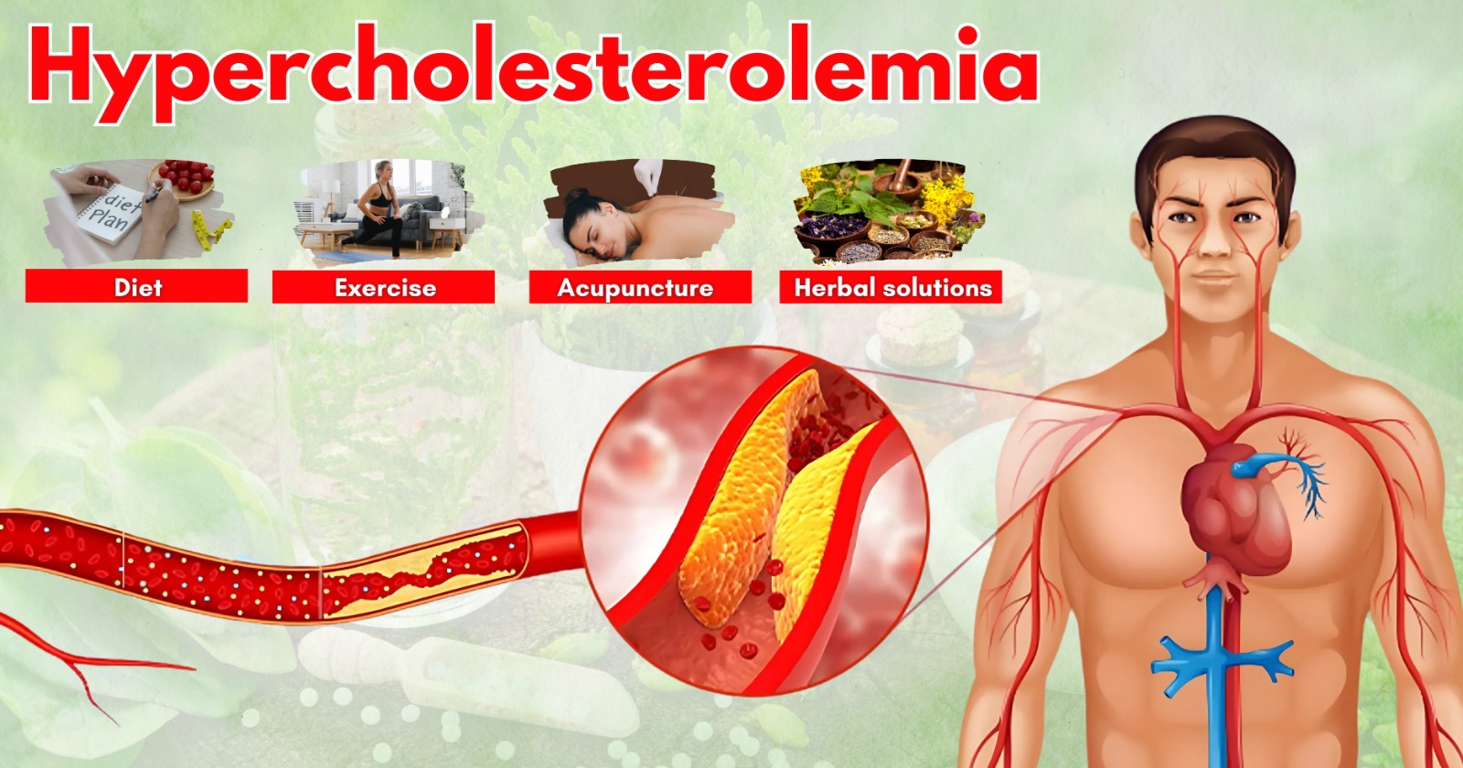 Hypercholesterolemia: Causes, Prevention & Natural Treatments for Heart Health