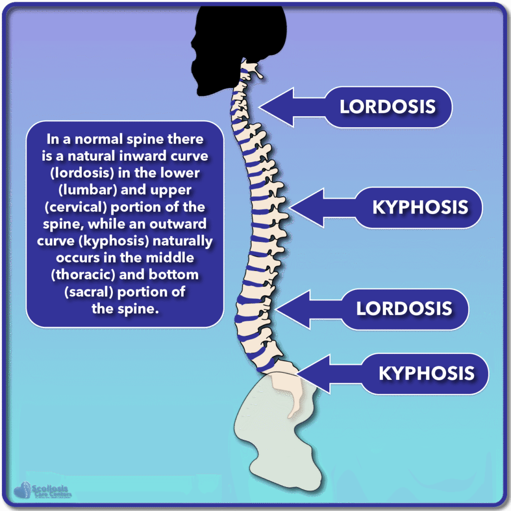 Types of Spinal Curves